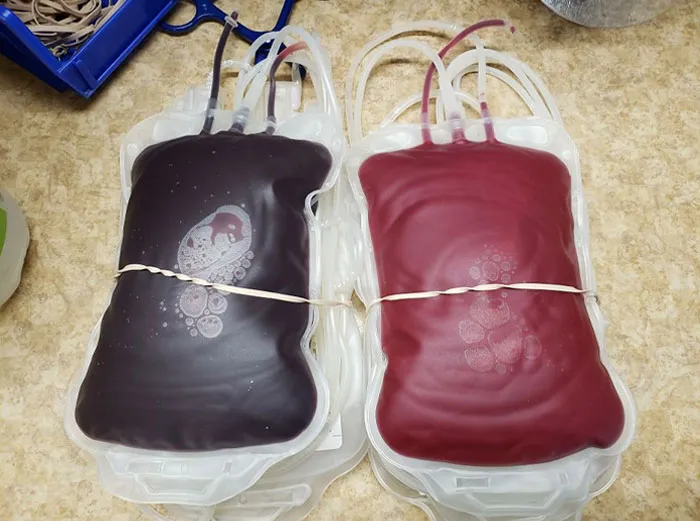 La sangre de una vena y la sangre de una arteria. La sangre es más oscura sin oxígeno, no azul.