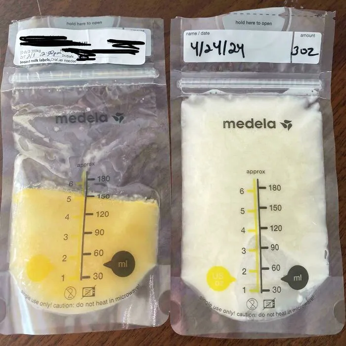 Diferencia de color de la leche materna 3 días después del parto frente a 8 semanas después del parto