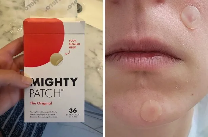 Zap Zits And Banish Blemishes With The Award-Winning <a Style="Display:inline;" Href="Https://Www.amazon.com/Mighty-Patch-Hydrocolloid-Absorbing-Count/Dp/B074pvtpbw?ie=utf8&th=1&linkcode=ll1&tag=bpwoodpecker-20&linkid=a64876ed8466d3af08787f02bcac3314&language=en_us&ref_=as_li_ss_tl" Target="_blank"><span Style="Font: Inherit; Color: #d74b1f;"> Mighty Patch Pimple Patches</Span>, A Discreet And Effective Solution For Acne-Prone Skin