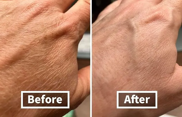 Smooth Out Wrinkles And Crepey Skin With The Indulgent <a Style="Display:inline;" Href="Https://Www.amazon.com/Gold-Bond-Corrector-Smoothing-Concentrate/Dp/B08yqx3skh?ie=utf8&th=1&linkcode=ll1&tag=bpwoodpecker-20&linkid=88e510a5242293a5ff1271f4abd1b293&language=en_us&ref_=as_li_ss_tl" Target="_blank"><span Style="Font: Inherit; Color: #d74b1f;"> Age Renew Crepe Corrector Body Lotion</Span>, A Rich And Rejuvenating Treat For Dry, Mature Skin