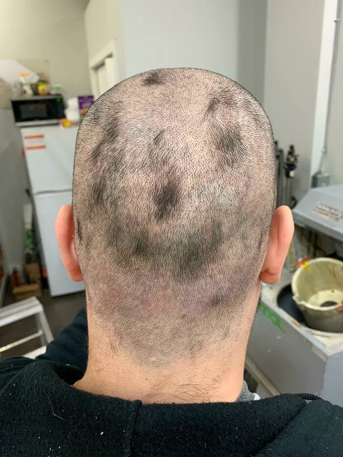 My First Attempt At "Shaving" My Head. Been At Work For Two Days Like This And Didn’t Even Realize Until A Coworked Asked If I'm Ok