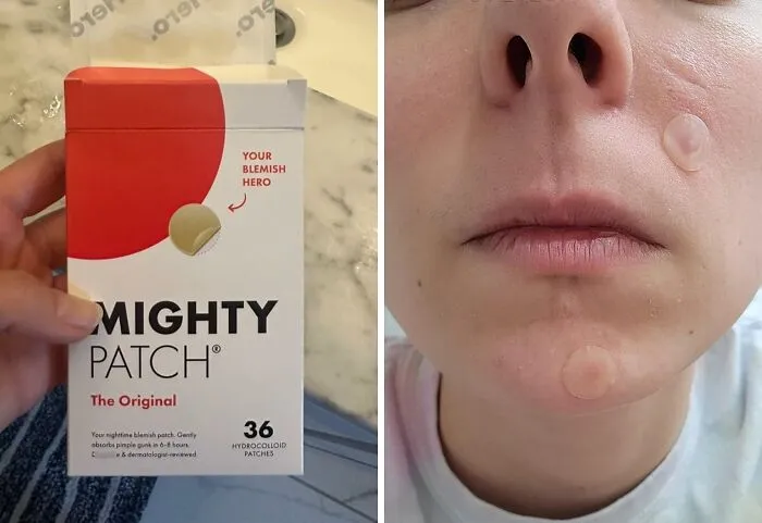 Zap Zits Into Oblivion With <a Style="Display:inline;" Href="Https://Www.amazon.com/Mighty-Patch-Hydrocolloid-Absorbing-Pimple/Dp/B07b4kqvk6?ie=utf8&th=1&linkcode=ll1&tag=bpibis-20&linkid=8cbce110fee2423bae8f52f63ef86a9c&language=en_us&ref_=as_li_ss_tl" Target="_blank"><span Style="Font: Inherit; Color: #d74b1f;"> Pimple Patches</Span>, Discreet And Effective Spot Treatments For A Clearer Complexion