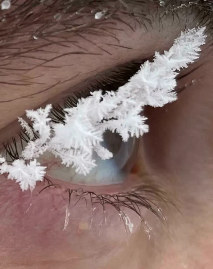 The Frost That Formed On My Eyelashes During A Cold Winter Hike