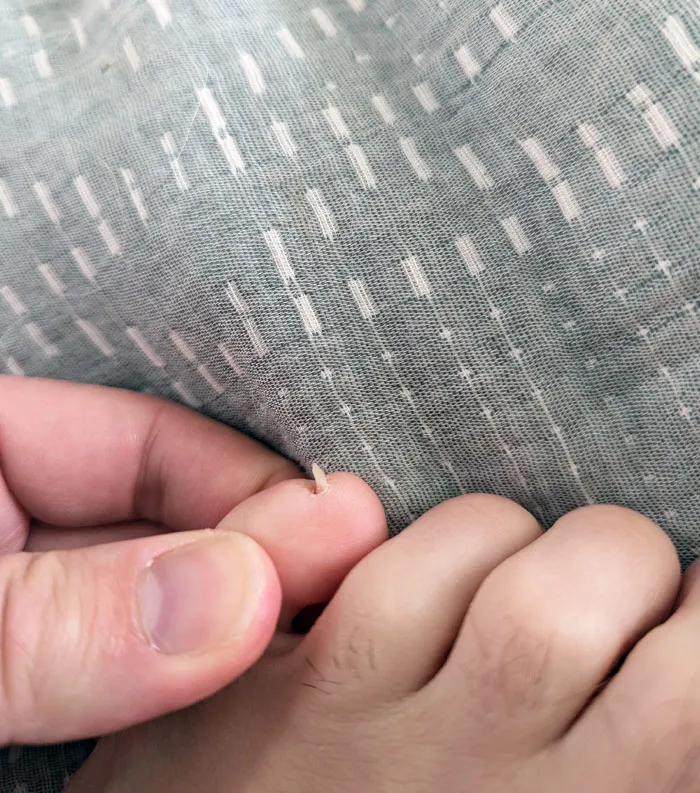 My Pinky Toe Nails Grow Completely Vertical