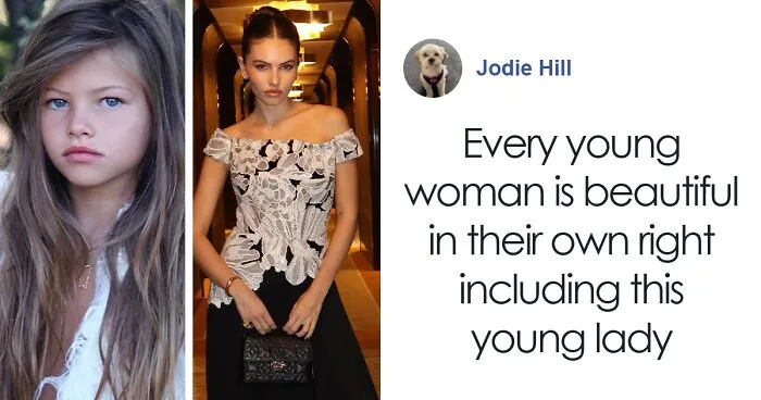 "I Feel Sorry For Her": People React To New Photos Of World's "Most Beautiful Girl"