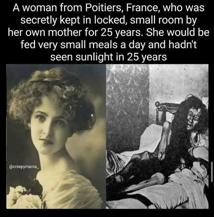 Two photographs of a woman; one elegant and another depicting her gaunt after 25 years of confinement, showcasing weird facts.