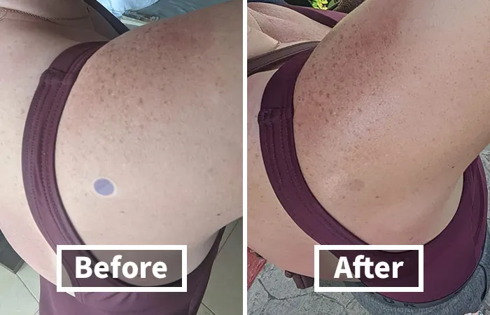 Stay Sun-Safe With <a Style="Display:inline;" Href="Https://Www.amazon.com/Spotmyuv-Stickers-Sunscreen-Dermatrue-Technology/Dp/B08x6b2t43?ie=utf8&linkcode=ll1&tag=bpgorilla-20&linkid=b4963b22c8dd5d75a8e1388009e2942c&language=en_us&ref_=as_li_ss_tl" Target="_blank"><span Style="Font: Inherit; Color: #d74b1f;"> UV Detection Stickers</Span> And Keep Track Of Your Sun Exposure. These Handy Stickers Change Color To Let You Know When It's Time To Reapply Sunscreen, Ensuring You Stay Protected Every Day