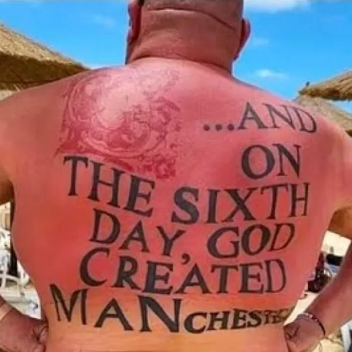 Epic tattoo fail on a sunburned back, displaying large text about Manchester under a beach umbrella.