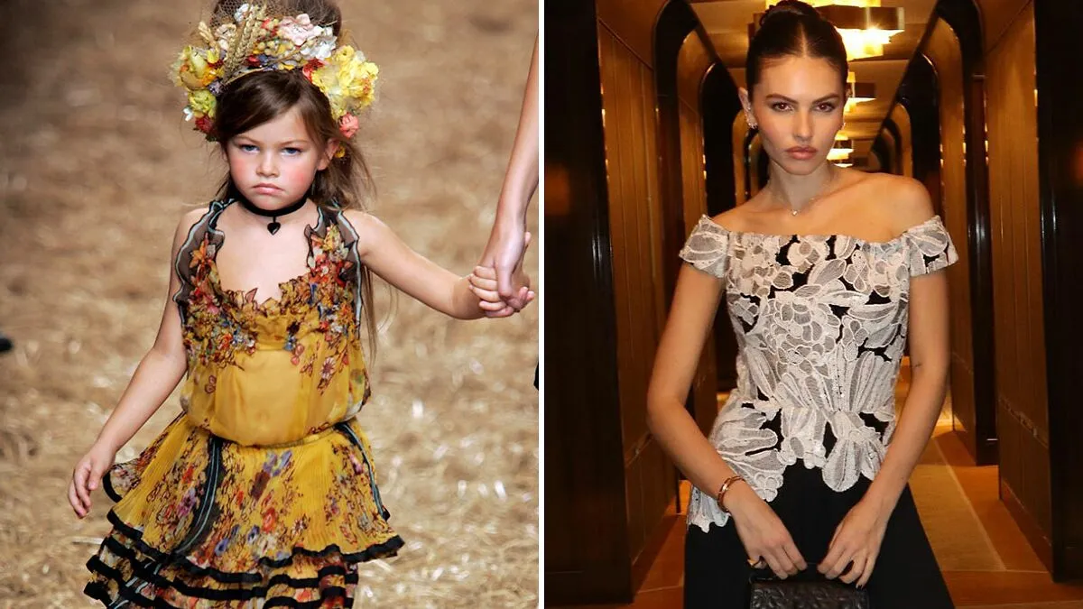 "I Feel Sorry For Her": People React To New Photos Of World's "Most Beautiful Girl"