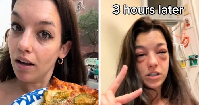 "Crazy": Woman Ends Up In The ER With Swollen Face After Visiting Pickle-Themed Food Festival