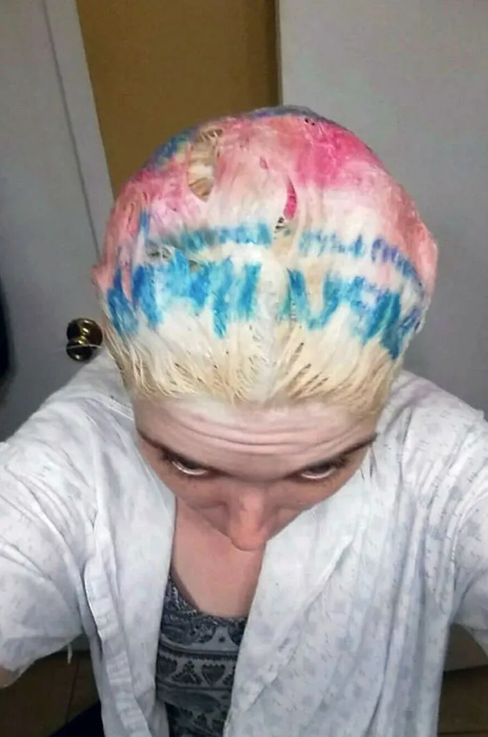 Plastic Bag Used To Retain Heat While Bleaching Hair. Pure Genius