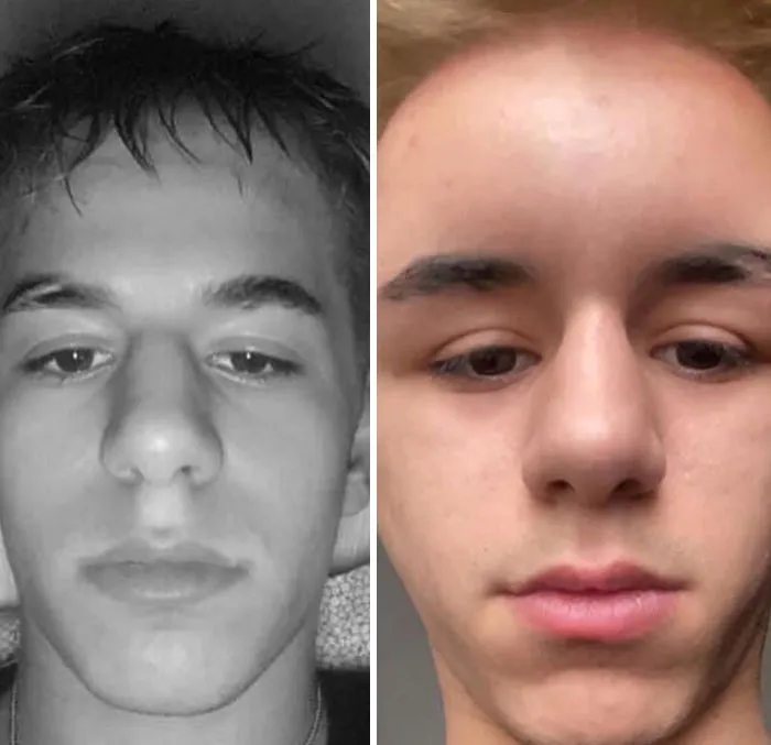 Mi amigo se tiñó el cabello: nos enteramos de que es alérgico