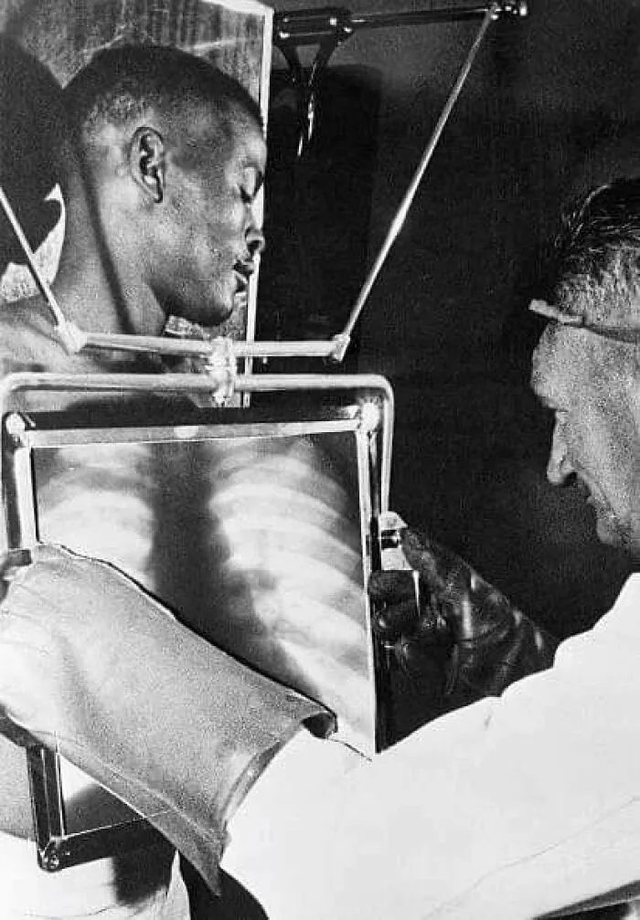 Un trabajador de una mina de diamantes es sometido a una radiografía al final de cada turno antes de abandonar las minas. Sudáfrica, 1954