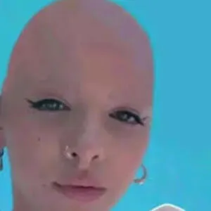 Bald Melanie Martinez