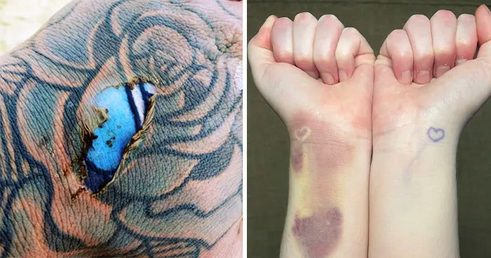 "My Eye Is Gradually Losing Its Color": 50 Interesting Human Body Pics