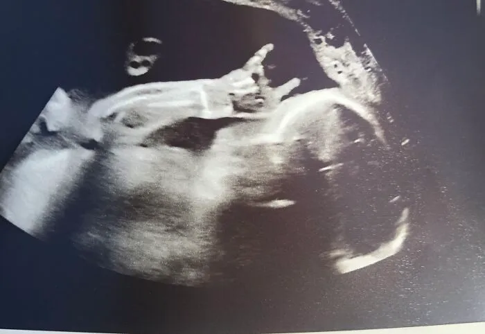 I’m 27 Weeks Pregnant Now And This Is What My Son Did Today