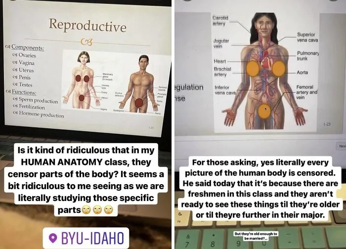 A University Anatomy Course Censoring Body Parts