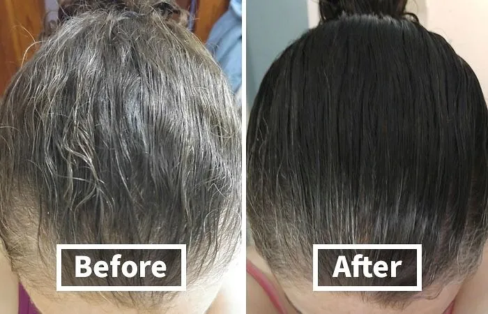 <a Style="Display:inline;" Href="Https://Www.amazon.com/Biotin-Hair-Shampoo-Thinning-Moisturizing/Dp/B01encboa0?ie=utf8&linkcode=ll1&tag=bpstingray-20&linkid=3e190d51fb5bf7713376124bc8ef014e&language=en_us&ref_=as_li_ss_tl" Target="_blank"> <span Style="Font:inherit;color:#d74b1f;"> Rosemary And Biotin Shampoo</Span> Made Sure We Have Better Hair Now Than At The Beginning Of The Year!