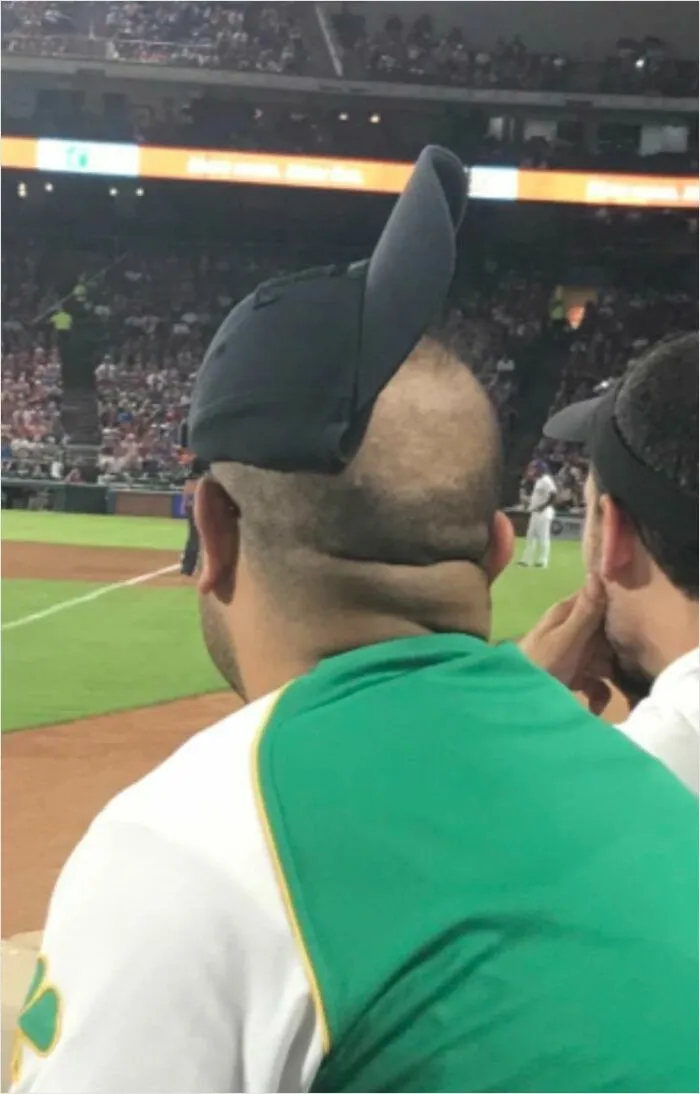 Parece que se ha photoshopeado mal la gorra