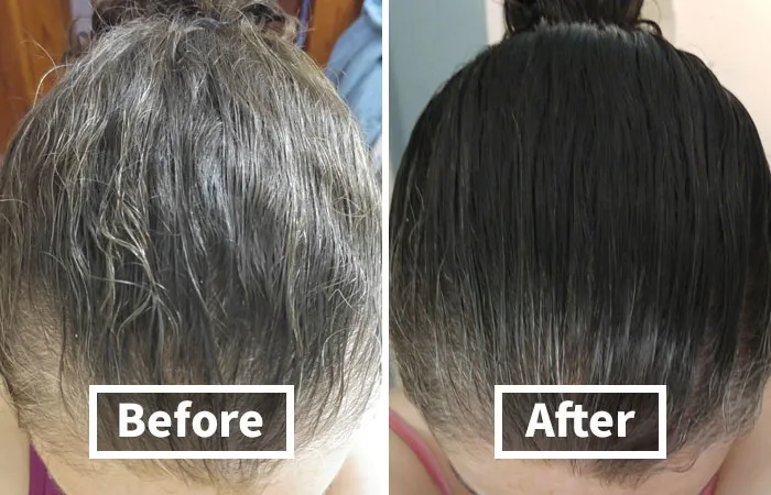 <a Style="Display:inline;" Href="Https://Www.amazon.com/Biotin-Hair-Shampoo-Thinning-Moisturizing/Dp/B01encboa0?ie=utf8&linkcode=ll1&tag=bpdonkey-20&linkid=329f6edfef6c6bce2d38f9ac27eea832&language=en_us&ref_=as_li_ss_tl" Target="_blank"> <span Style="Font:inherit;color:#d74b1f;"> Biotin Rosemary Shampoo</Span> Gives Us Hope That We Might Save Our Locks In 2025