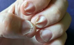 50 Interesting Medical Cases That Might Make You Appreciate The Human Body (New Pics)