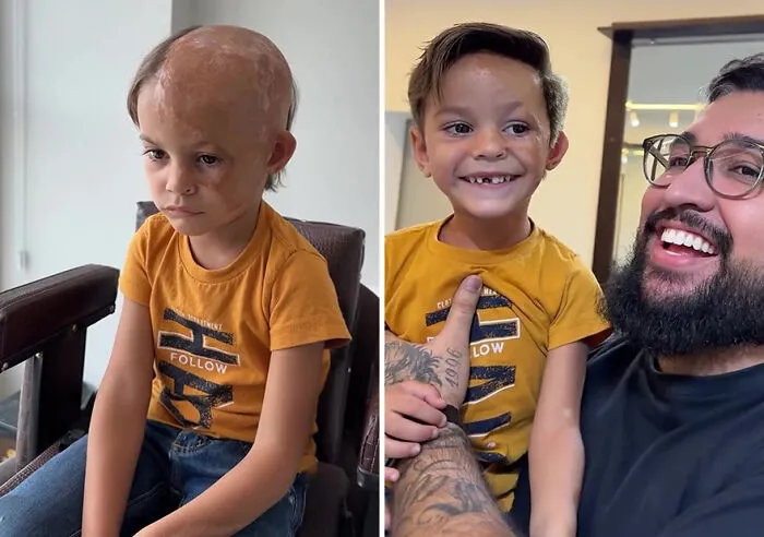 Heartwarming Transformations: 20 Pictures Of Kids Receiving Hair Prosthetics From This Barber