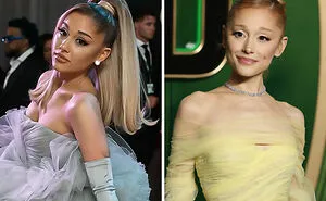20 Stars Whose Dramatic Transformations Had Everyone Talking This Year