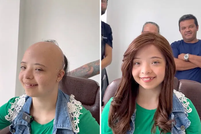 Heartwarming Transformations: 20 Pictures Of Kids Receiving Hair Prosthetics From This Barber