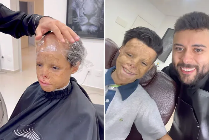Heartwarming Transformations: 20 Pictures Of Kids Receiving Hair Prosthetics From This Barber