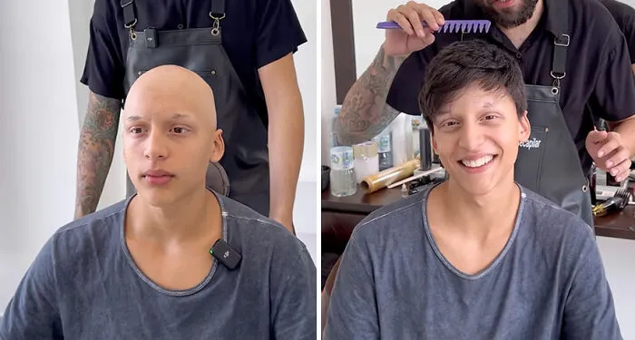 Heartwarming Transformations: 20 Pictures Of Kids Receiving Hair Prosthetics From This Barber