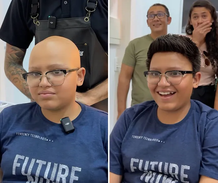 Heartwarming Transformations: 20 Pictures Of Kids Receiving Hair Prosthetics From This Barber