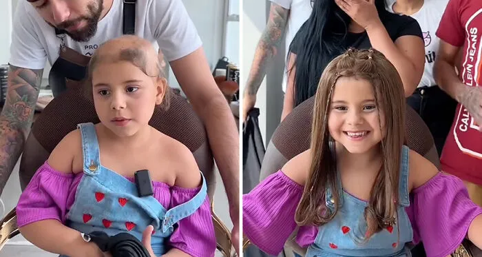 Heartwarming Transformations: 20 Pictures Of Kids Receiving Hair Prosthetics From This Barber