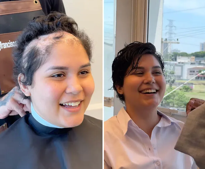 Heartwarming Transformations: 20 Pictures Of Kids Receiving Hair Prosthetics From This Barber
