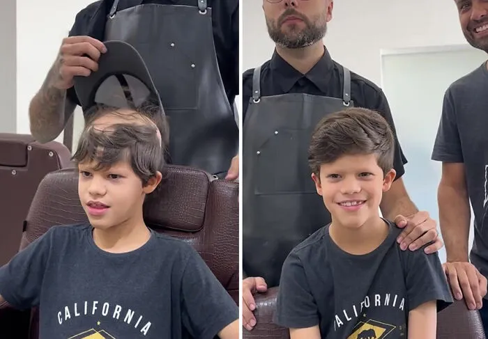 Heartwarming Transformations: 20 Pictures Of Kids Receiving Hair Prosthetics From This Barber