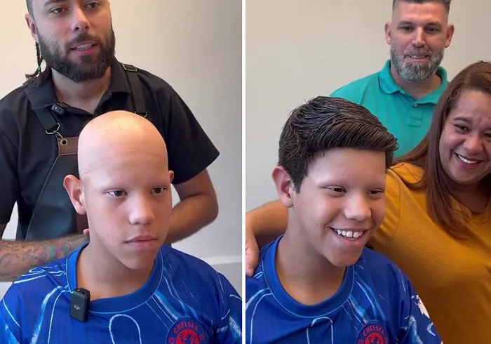 Heartwarming Transformations: 20 Pictures Of Kids Receiving Hair Prosthetics From This Barber