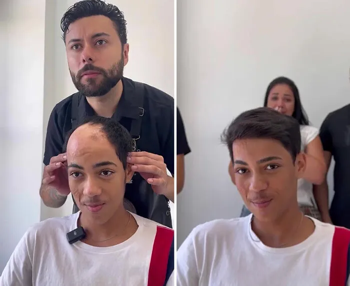 Heartwarming Transformations: 20 Pictures Of Kids Receiving Hair Prosthetics From This Barber