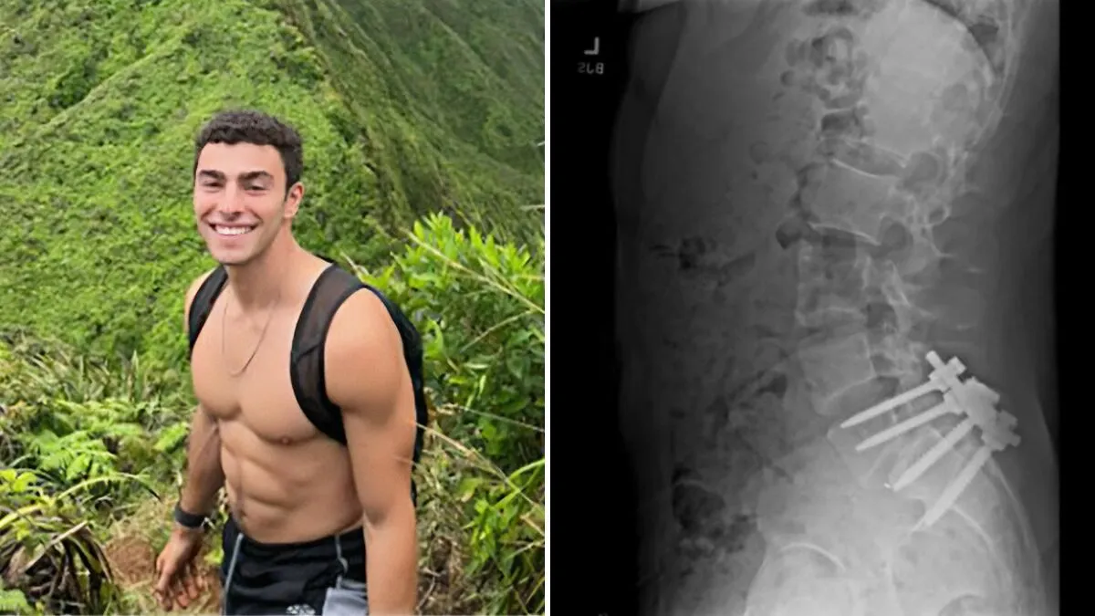 People Think Accident That Affected Luigi Mangione’s Love Life Could Be Behind Alleged Homicide