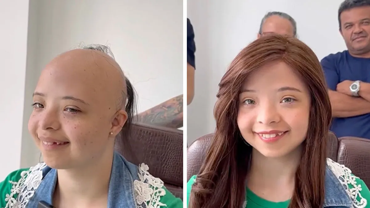 Heartwarming Transformations: 20 Pictures Of Kids Receiving Hair Prosthetics From This Barber