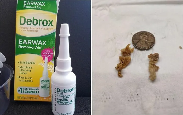 Clear The Way To Better Hearing And A Healthier Ear Canal With <a Style="Display:inline;" Href="Https://Www.amazon.com/Debrox-Drops-Earwax-Removal-Drops/Dp/B00anl4z4i?ie=utf8&th=1&linkcode=ll1&tag=bpantelope-20&linkid=86747d8c35d1fda918379084aea49fd5&language=en_us&ref_=as_li_ss_tl" Target="_blank"><span Style="Font: Inherit; Color: #d74b1f;"> Debrox Ear Wax Removal Drops </Span>, A Gentle And Effective Solution For A Clearer, More Comfortable You