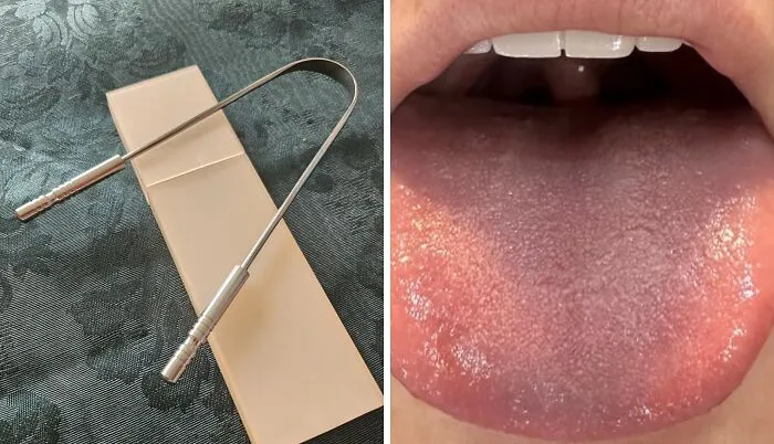 Banish Bad Breath And Reveal A Fresher, Cleaner Tongue With A <a Style="Display:inline;" Href="Https://Www.amazon.com/Copper-Tongue-Scraper-New-Improved/Dp/B088nzgrkr?ie=utf8&th=1&linkcode=ll1&tag=bpantelope-20&linkid=6c64269ca3e1e4dc2a9f4c1749d2f203&language=en_us&ref_=as_li_ss_tl" Target="_blank"><span Style="Font: Inherit; Color: #d74b1f;"> Tongue Scraper </Span>, A Simple Yet Effective Tool For A Healthier, More Confident Smile