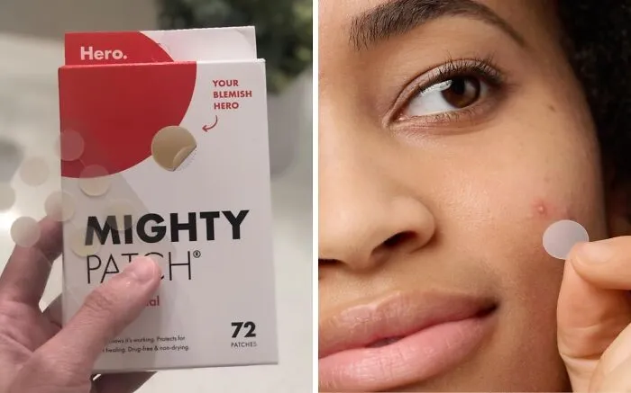 Stick It To Acne With <a Style="Display:inline;" Href="Https://Www.amazon.com/Mighty-Patch-Hydrocolloid-Absorbing-Count/Dp/B074pvtpbw?ie=utf8&th=1&linkcode=ll1&tag=bpantelope-20&linkid=a296d01a931f3a6b2d1621004dcef357&language=en_us&ref_=as_li_ss_tl" Target="_blank"><span Style="Font: Inherit; Color: #d74b1f;"> Pimple Patches </Span>, A Discreet And Effective Solution For Calming, Concealing, And Clearing Up Blemishes