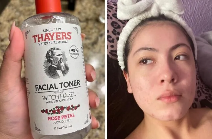 Balancing And Beautiful, <a Style="Display:inline;" Href="Https://Www.amazon.com/Thayers-Alcohol-Free-Petal-Formula-12-Facial/Dp/B007hd570q?ie=utf8&linkcode=ll1&tag=bpantelope-20&linkid=7e15141b800d520e884aa79f00d2fd46&language=en_us&ref_=as_li_ss_tl" Target="_blank"><span Style="Font: Inherit; Color: #d74b1f;"> Rose Petal Witch Hazel Facial Toner </Span> Gently Harmonizes Your Skin's Ph, Revealing A Radiant Complexion That Glows From Within