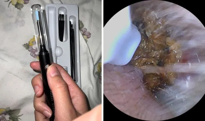 Get A Closer Look At What's Really Going On In There With The <a Style="Display:inline;" Href="Https://Www.amazon.com/Removal-Cleaner-Camera-Cleaning-Android/Dp/B0c4fzs8h3?ie=utf8&th=1&linkcode=ll1&tag=bpelk-20&linkid=2c11cb89559e3a81f759debf8c8d4397&language=en_us&ref_=as_li_ss_tl" Target="_blank"><span Style="Font: Inherit; Color: #d74b1f;"> Ear Wax Removal Kit With A Camera </Span> - Because, Let's Be Real, Ear Wax Is A Mystery We'd All Like To Solve