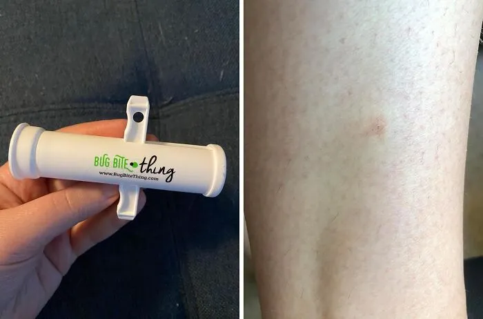  Just When We Thought We Just Have To Live With The Annoyance Of Bug Bites, We Stumble Across The Genius <a Style="Display:inline;" Href=" Https://Www.amazon.com/Bug-Bite-Thing-Suction-Remover/Dp/B01576dwqu?ie=utf8&linkcode=ll1&tag=bpbison-20&linkid=679e04f169ac91e2fb824d455de6fb7f&language=en_us&ref_=as_li_ss_tl" Target="_blank"><span Style="Font:inherit;color:#d74b1f;"> Bug Bite Suction Tool</Span>!