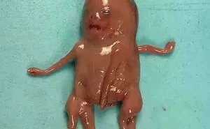 57 Fascinating And Unnerving Medical Photos Not Everyone Can Handle (New Pics)