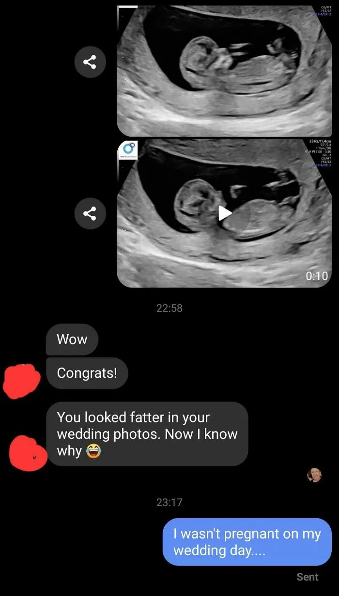 Family Friend Said I Looked Fat On My Wedding Day