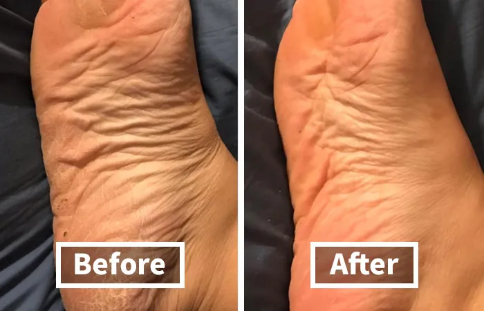 Heal And Soften Rough, Cracked Heels With <a Style="Display:inline;" Href="Https://Www.amazon.com/Okeeffes-Healthy-Feet-Cream-Ounce/Dp/B0002qb9ne?ie=utf8&th=1&linkcode=ll1&tag=bpelk-20&linkid=52a9f8eda3d6a7f6aae84d010f0bf3ce&language=en_us&ref_=as_li_ss_tl" Target="_blank"><span Style="Font: Inherit; Color: #d74b1f;"> O'keeffe's Foot Cream </Span>. This Rich And Nourishing Cream Provides Intense Moisturization, Helping To Repair And Transform Dry, Damaged Skin