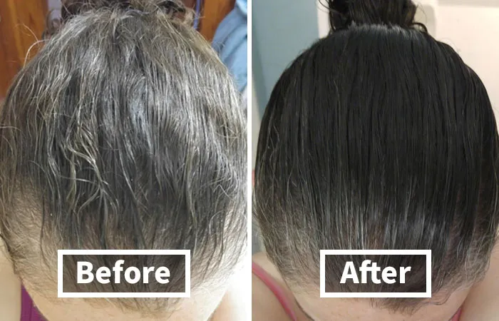 Give Your Locks A Little TLC With <a Style="Display:inline;" Href="Https://Www.amazon.com/Biotin-Hair-Shampoo-Thinning-Moisturizing/Dp/B01encboa0?crid=525u12y9ayq2&dib=eyj2ijoimsj9.c_nkanixq-H9ugo2pgjk3etqmc42xwyqtnowkyy4ltzdekltxmjzdfwvnugyoaqei_dkc-Y1wvwpi-Znndt3sue3gnfw0ybcnx2ts3_qxdfmstkwibgbuekpfa4_c2geldly_g8rkm6b76ltoijics4_ug9stcstkzmnceivqb5e9td5a0vlszvfaik0jnf8au0oxgctcydwwatg0jffg7t8ftbnxi6mser1szzu7dwskeziiadcylp9cil3uku-Bkbf3xjgvpa2ajn8zf8zr0qu_7oqqxxfmz8-Gkbytzq.sytvvebolq9d5xnqzcc0viigtqqgnx6qscedvnnzrky&dib_tag=se&keywords=biotin+shampoo&qid=1737036551&sprefix=biotin+sha%2caps%2c216&sr=8-1-Spons&sp_csd=d2lkz2v0tmftzt1zcf9hdgy&psc=1&linkcode=ll1&tag=bpelk-20&linkid=7f470bd70df3383b3b6e84c4bdfb8925&language=en_us&ref_=as_li_ss_tl" Target="_blank"><span Style="Font: Inherit; Color: #d74b1f;"> Rosemary And Biotin Shampoo For Thinning Hair </Span> - It's Like A Drink Of Water For Your Parched, Thinning Tresses!
