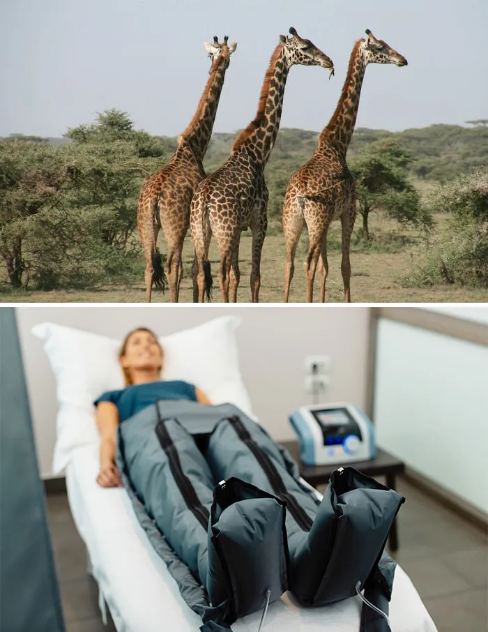 Venous Leg Ulcers & Compression Therapy
