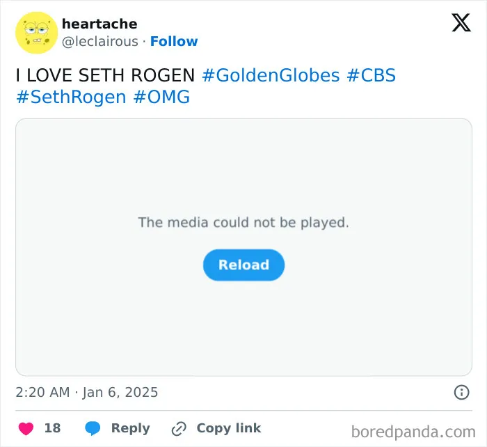 Seth Rogen's Bald Spot
